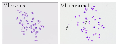 Figure: Chromosome analysis of halved oocyte injected with primary spermatocyte.